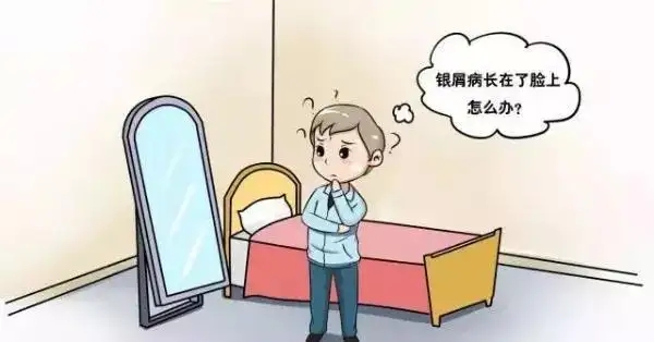 牛皮癣的治疗原则是什么