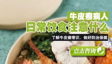 儿童牛皮癣在饮食上要注意什么